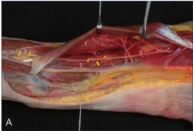 image-20250701225441562