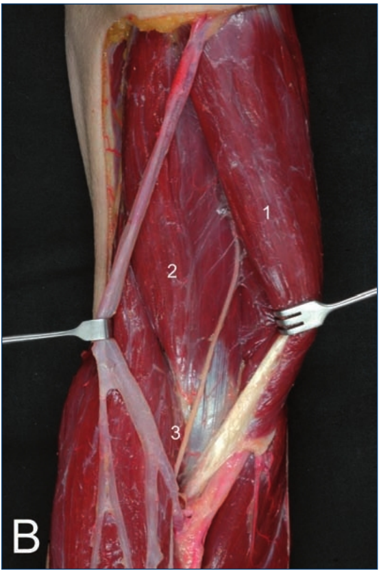 image-20250701225612994